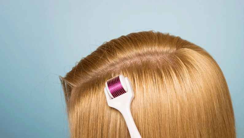 Derma Roller for Hair Loss Treatment in Mumbai | Microneedling 