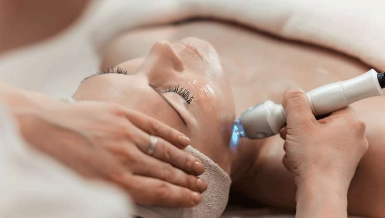 Laser skin treatment