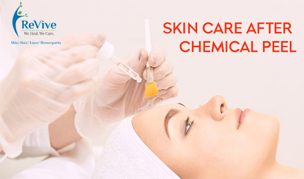 Skin care after chemical peel