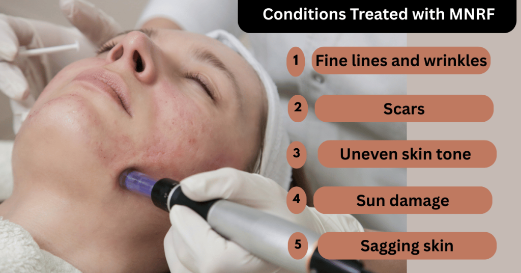 Conditions Treated with MNRF