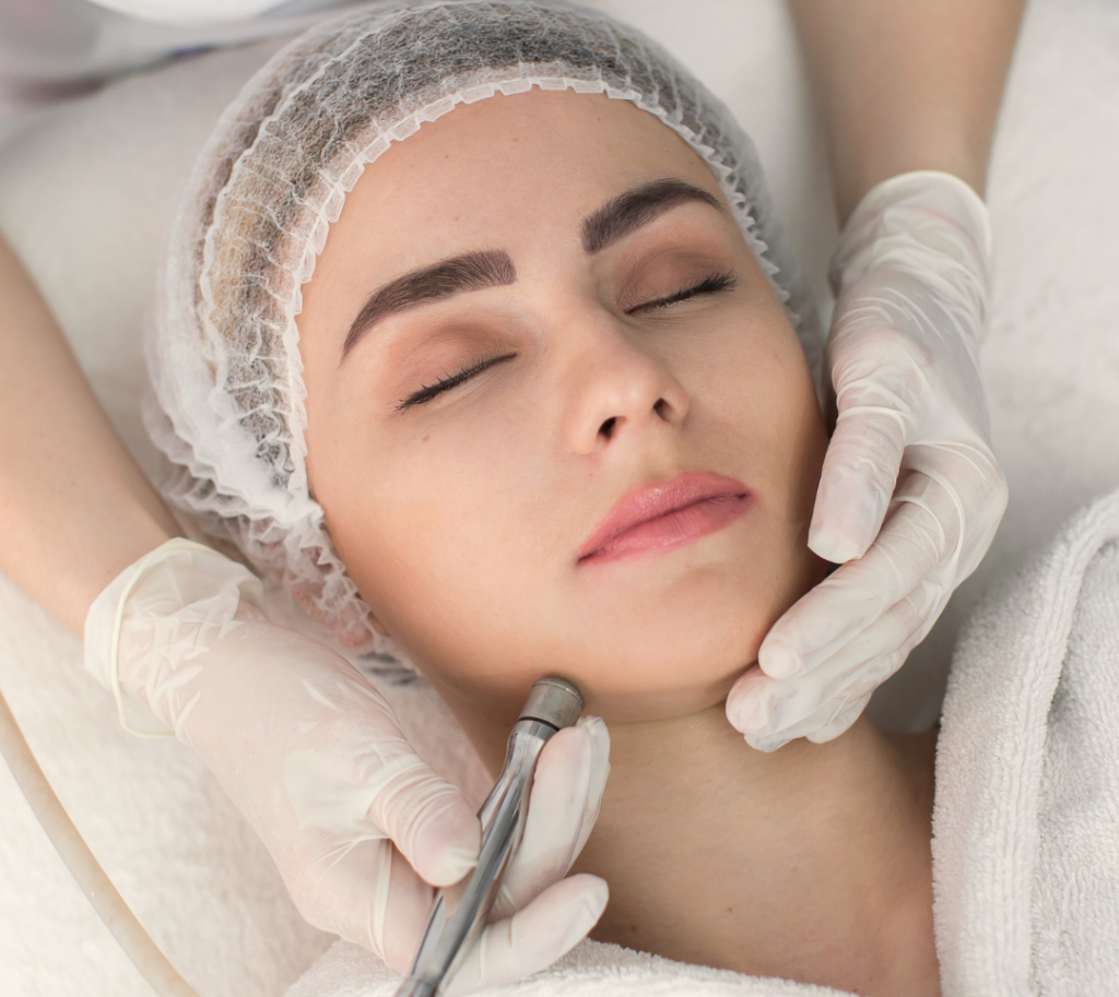 Microdermabrasion