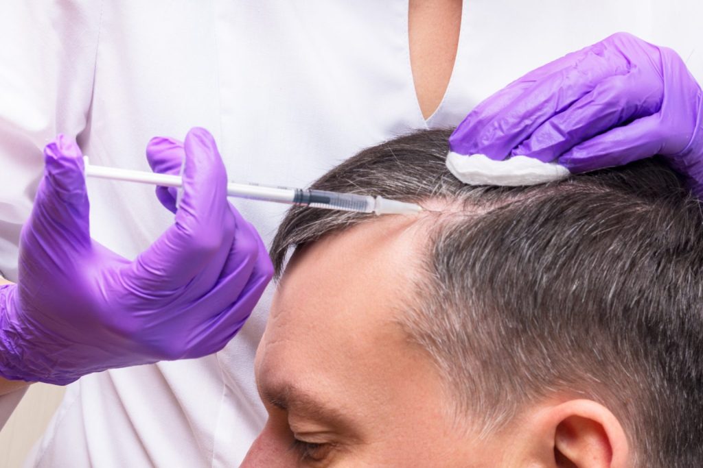 Different Types of PRP for Hair