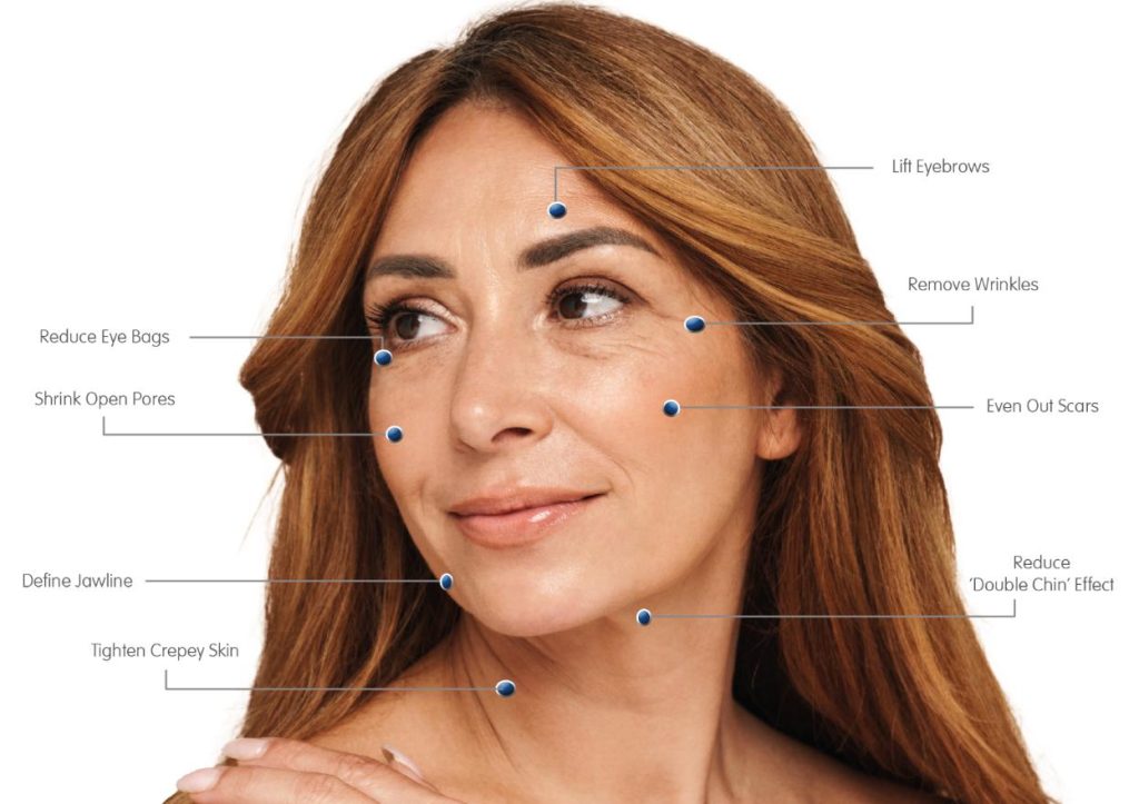 Common Areas Treated with HIFU in Mumbai with Dr. Manisha Saney