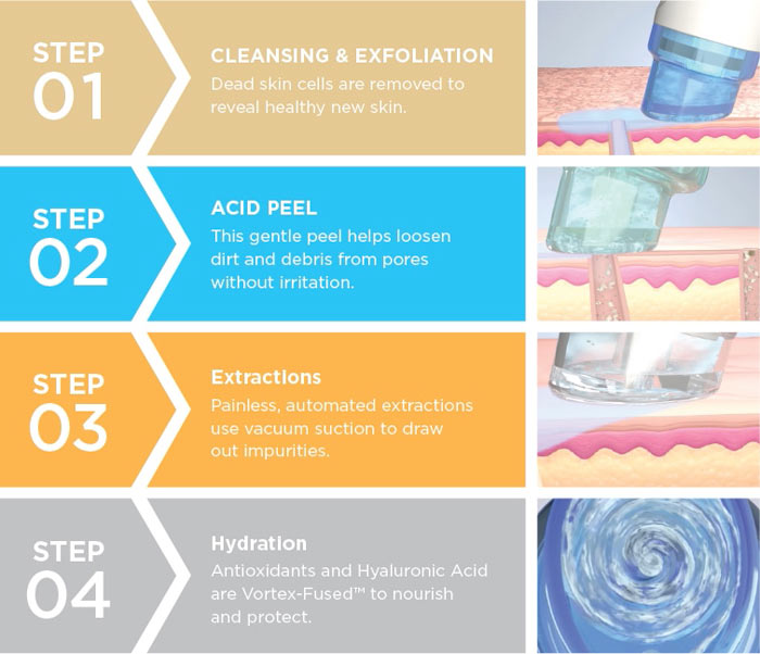 Procedure of Hydrafacial Treatment