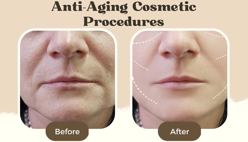 What to Expect During and After the Procedure in Mumbai
