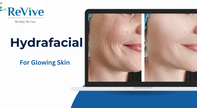 Why Everyone’s Talking About Hydrafacial for Glowing Skin